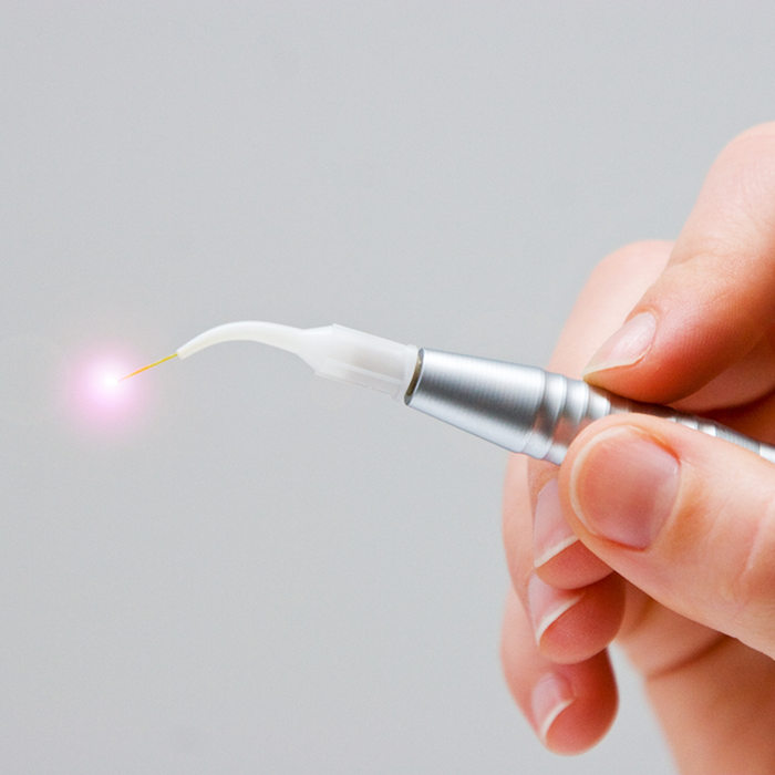 Hand holding a pen like dental laser device