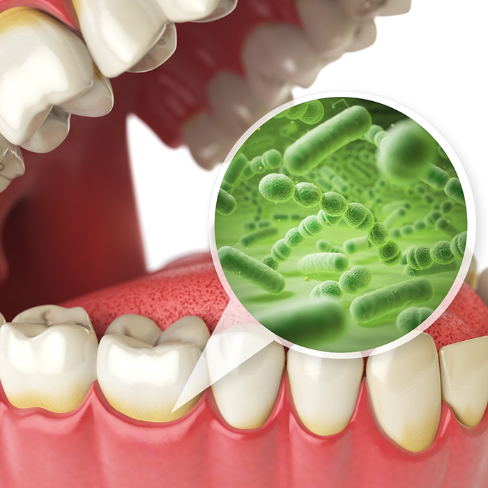 Illustration of a mouth with a zoomed in section of the gums showing bacteria