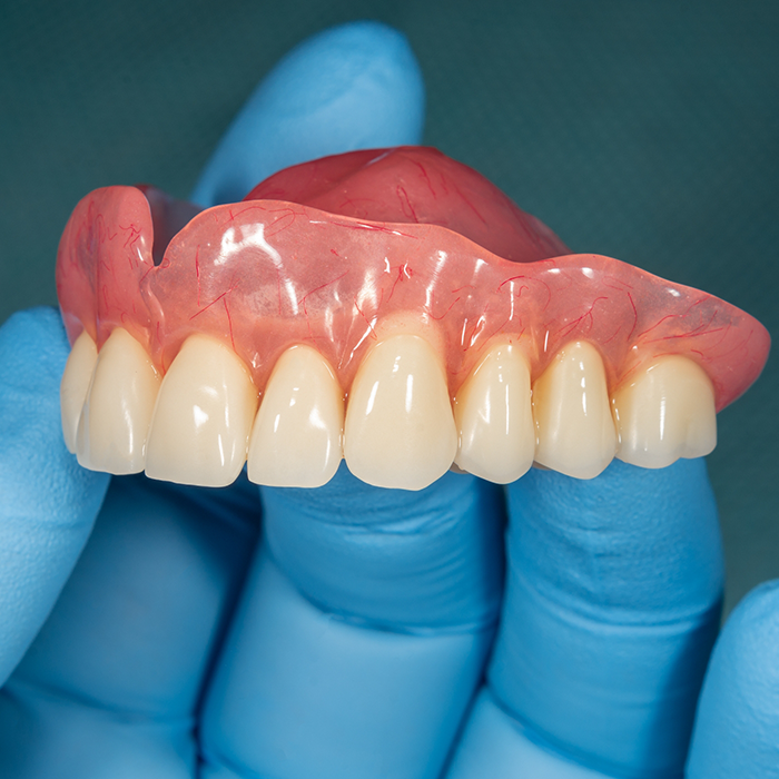 Hand holding a full upper denture