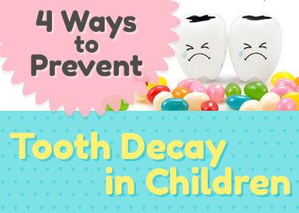 Goose Creek dentists, Dr. Zuffi, Dr. Barganier and Dr. Hassin at Carolina Complete Dental shares four easy ways to help prevent tooth decay in children so they can have a head start on a healthy, happy smile for life.