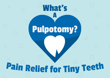 Goose Creek dentists, Dr. Barganier, Dr. Zuffi, Dr. Williams, and Dr. McAdams of Carolina Complete Dental, explain what a pulpotomy is, when they’re recommended, and the steps of the procedure for saving baby teeth.