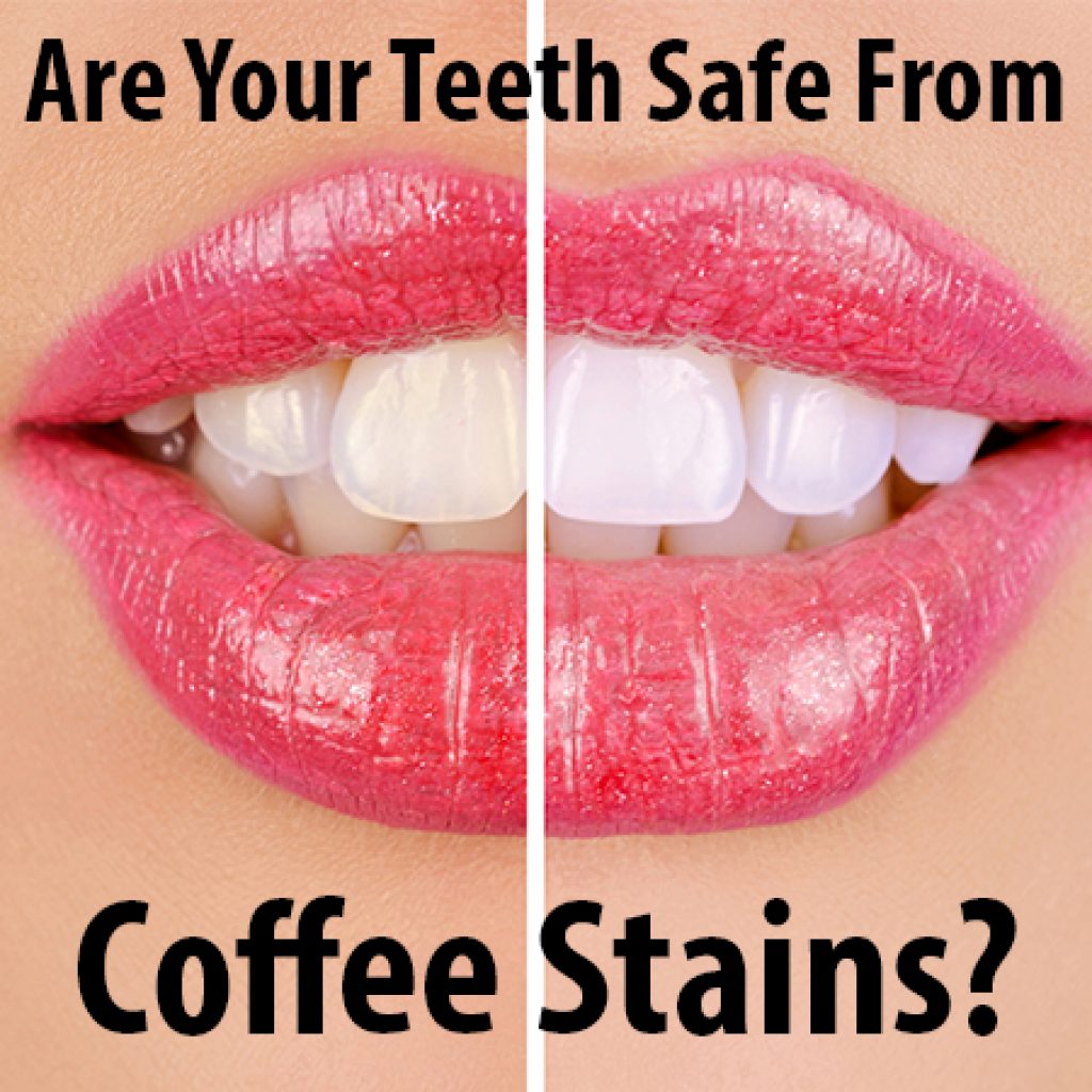 Coffee Stains on Teeth | Carolina Complete Dental